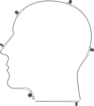 情侣头像